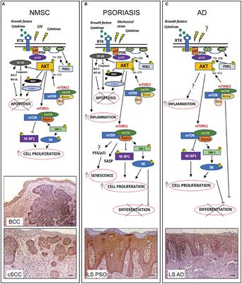 Recent Updates on the Involvement of PI3K/AKT/mTOR Molecular Cascade in the Pathogenesis of Hyperproliferative Skin Disorders